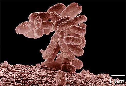 Bacteria Escherichia coli